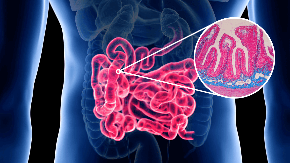 Intestinal Lining
